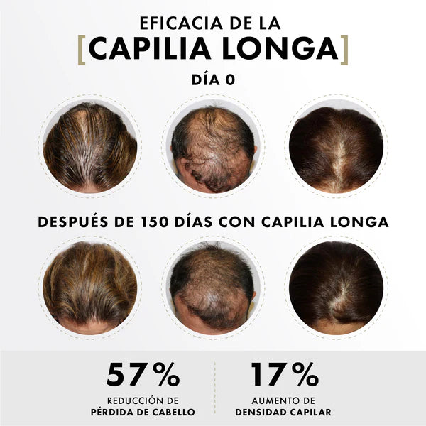 Activador capilar con células madre de cúrcuma y factores de crecimiento