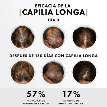 Activador capilar con células madre de cúrcuma y factores de crecimiento